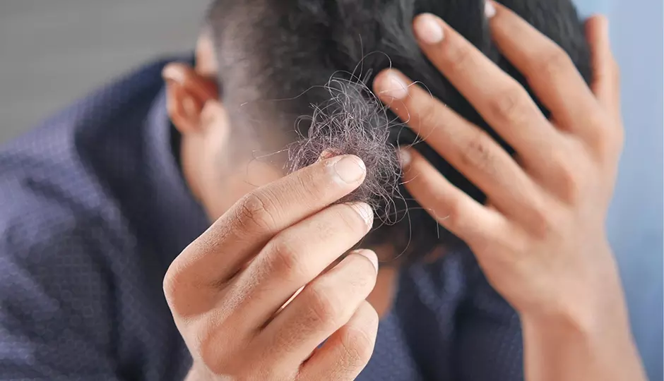 September is Alopecia Awareness Month