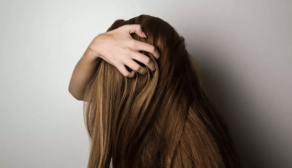 Different Types of Alopecia Explained Different Types of Alopecia Explained