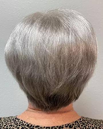 17 womens before and after photo 01 solutions before after womens gallery photos of womens hair loss 17 womens before and after photo 01
